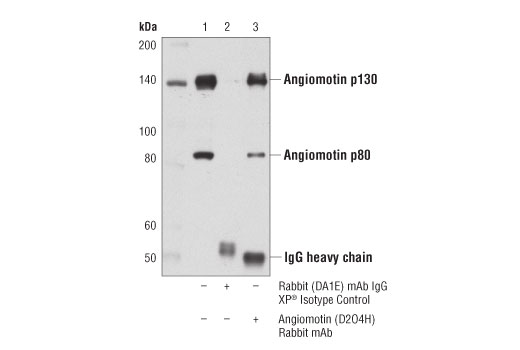 Immunoprecipitation Image 1: Angiomotin (D2O4H) Rabbit Monoclonal Antibody