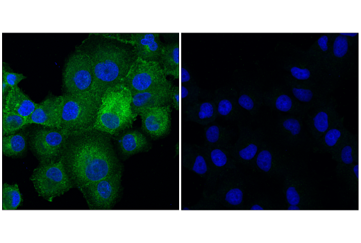 Immunofluorescence Image 1: beta2-microglobulin (D8P1H) Rabbit Monoclonal Antibody (BSA and Azide Free)