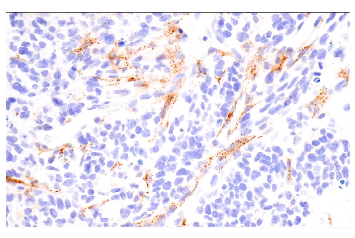 Immunohistochemistry Image 2: Cathepsin K (E7U5N) Rabbit Monoclonal Antibody