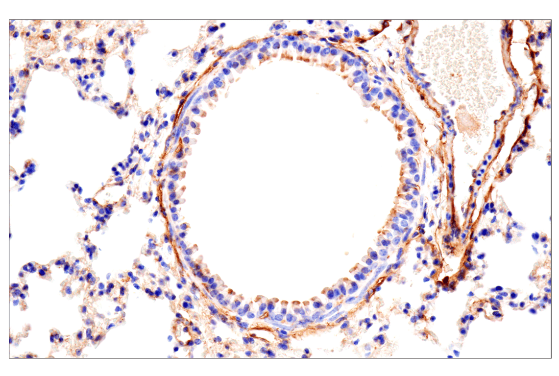 Immunohistochemistry Image 3: CD81 (D5O2Q) Rabbit Monoclonal Antibody
