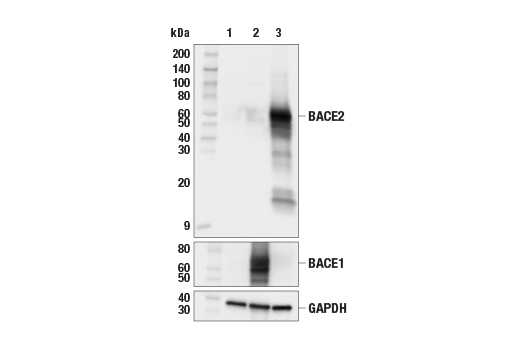 Western Blotting Image 2: BACE2 (E3Y9Q) Rabbit Monoclonal Antibody