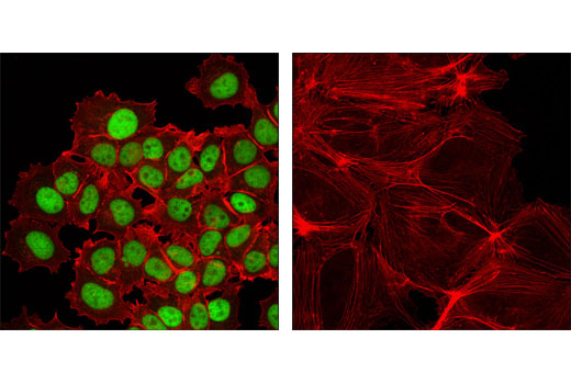 Immunofluorescence Image 1: GATA-3 (D13C9) Rabbit Monoclonal Antibody (BSA and Azide Free)