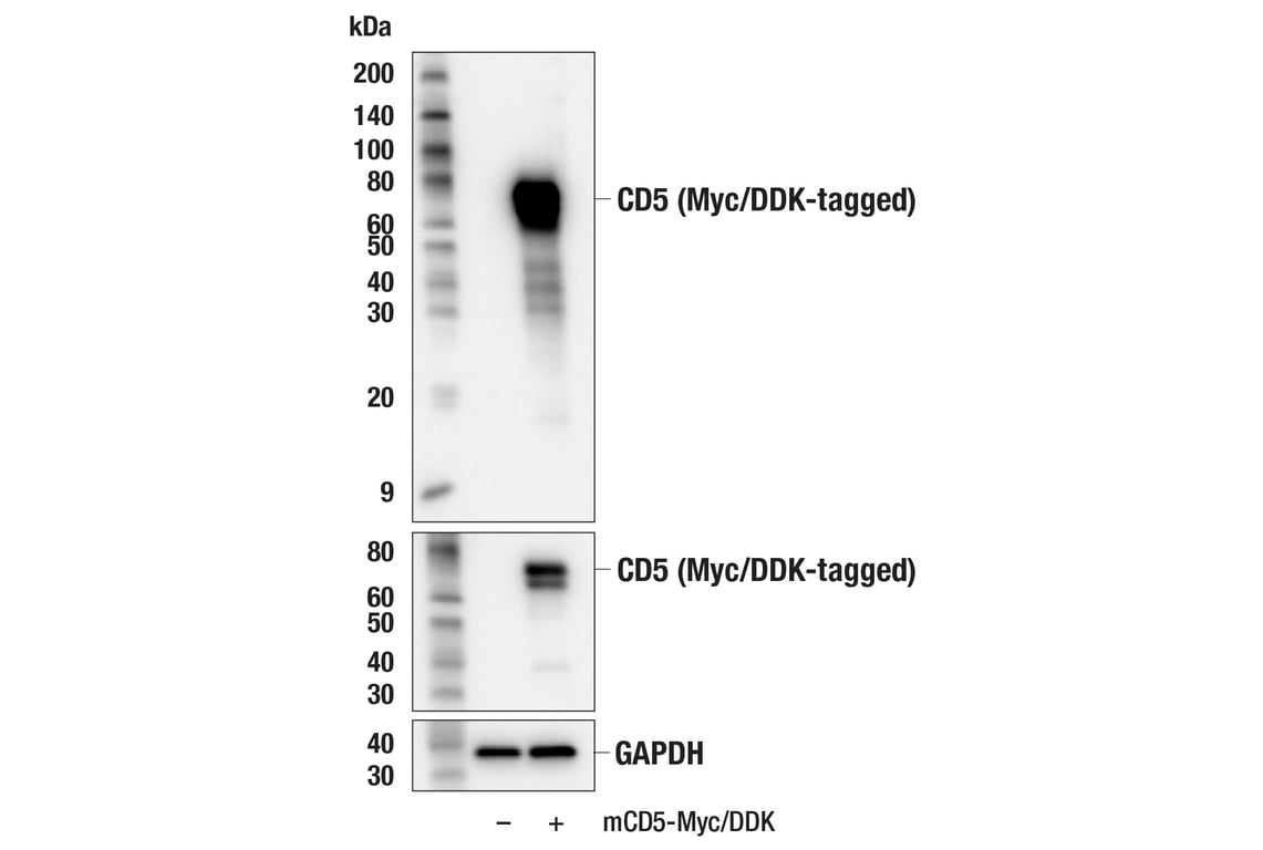 Western Blotting Image 2: CD5 (E6N9S) Rabbit Monoclonal Antibody