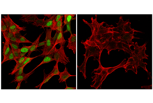 Immunofluorescence Image 1: Cyclin D1 (E3P5S) Rabbit Monoclonal Antibody (BSA and Azide Free)