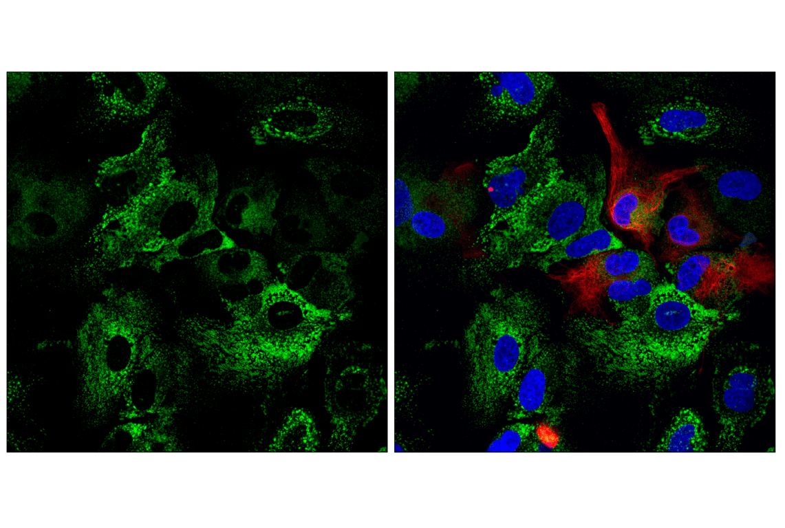 undefined Image 27: ER Stress Antibody Sampler Kit