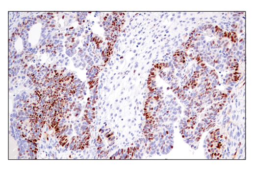 Immunohistochemistry Image 5: Cyclin D1 (E3P5S) Rabbit Monoclonal Antibody