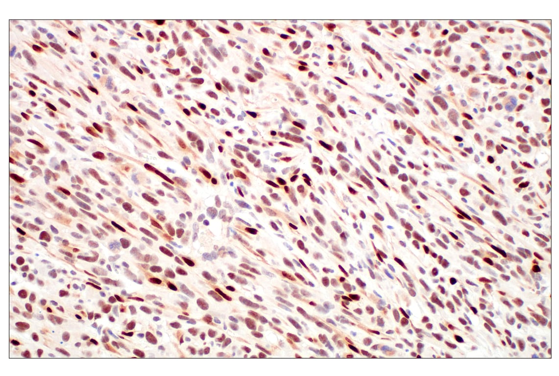 Immunohistochemistry Image 10: Basic FGF (E5Y6M) Rabbit Monoclonal Antibody