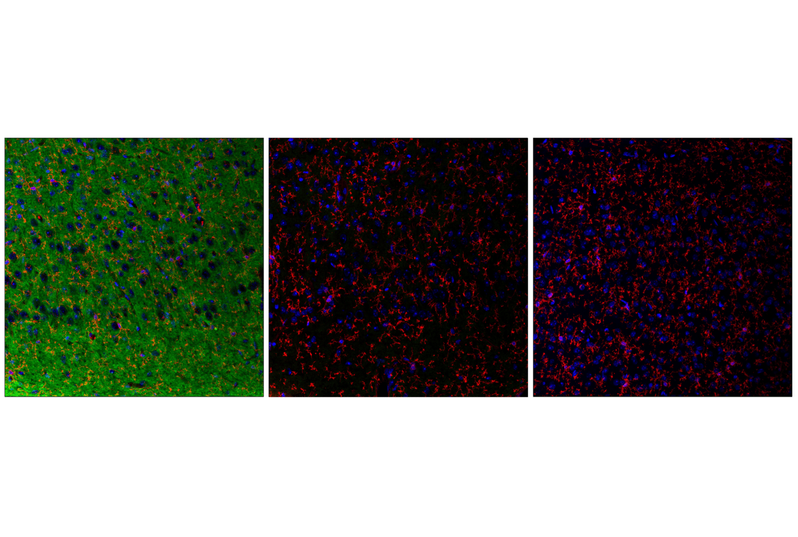 Immunofluorescence Image 1: Phospho-Tau (Ser396) (F3S9T) Rabbit Monoclonal Antibody