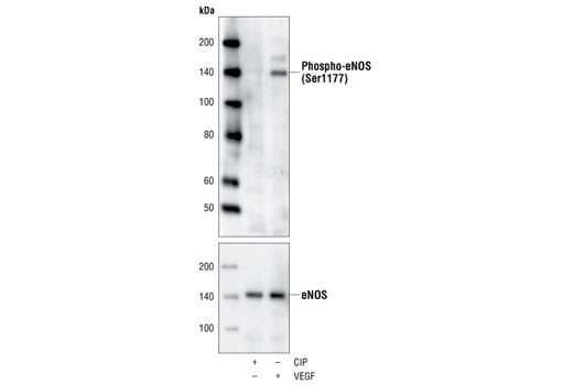 Western Blotting Image 1: Phospho-eNOS (Ser1177) (C9C3) Rabbit mAb