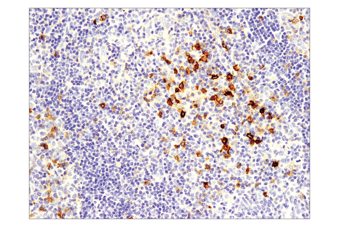 Immunohistochemistry Image 1: OX40 (E9U7O) Rabbit Monoclonal Antibody (BSA and Azide Free)