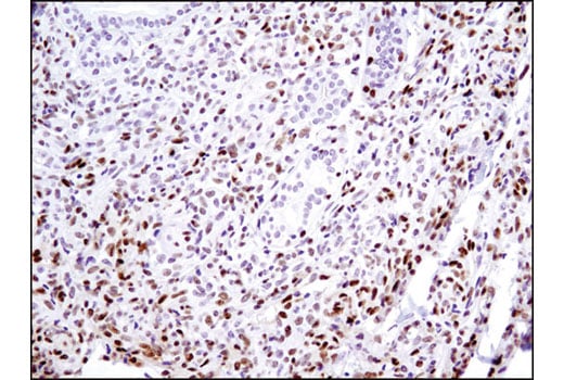 Immunohistochemistry Image 3: SignalStain<sup>®</sup> DAB Substrate Kit