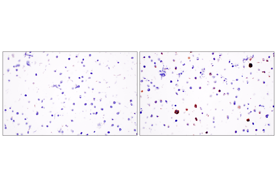 Immunohistochemistry Image 7: CXCL13 (F6A4R) Rabbit Monoclonal Antibody