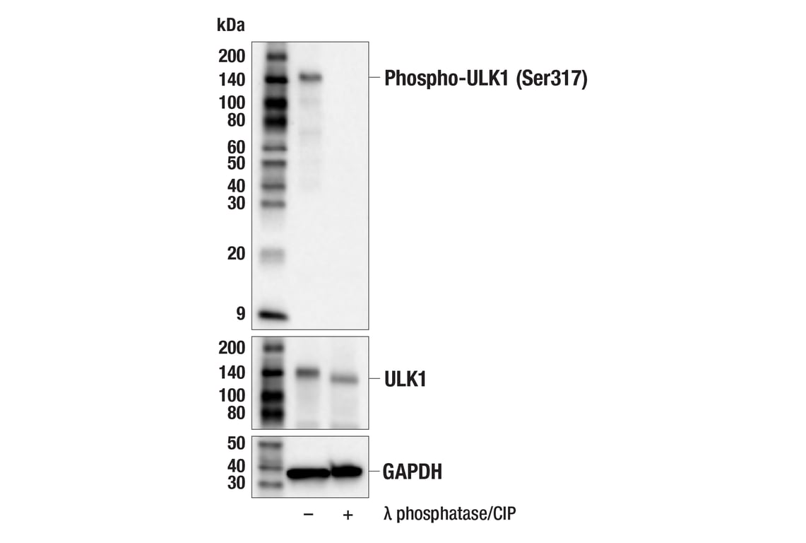 Western Blotting Image 2: Phospho-ULK1 (Ser317) (F1Z6C) Rabbit mAb