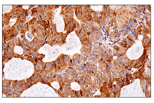 Immunohistochemistry Image 2: APP (E3F3P) Rabbit Monoclonal Antibody