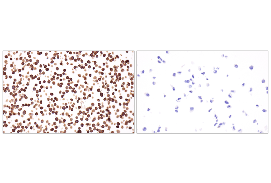 Immunohistochemistry Image 9: CD79A (F3Z1H) Rabbit Monoclonal Antibody