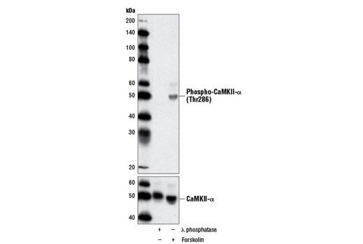 Western Blotting Image 1: Phospho-CaMKII (Thr286) (D21E4) Rabbit mAb