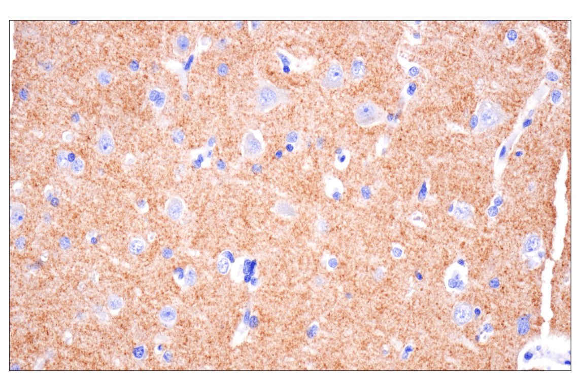 Immunohistochemistry Image 3: VGLUT2 (F1T6V) Rabbit Monoclonal Antibody