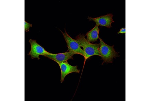 Immunofluorescence Image 1: Stathmin (D1Y5A) Rabbit Monoclonal Antibody
