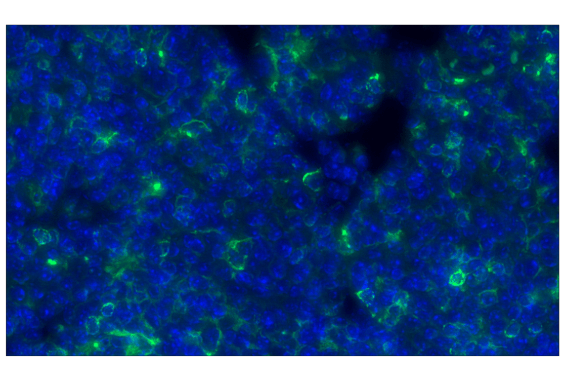Immunohistochemistry Image 2: CD11c (D1V9Y) Rabbit Monoclonal Antibody (Alexa Fluor<sup>®</sup> 488 Conjugate)