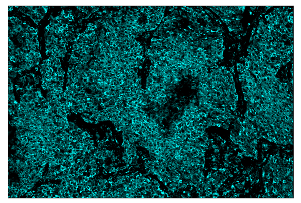 Immunohistochemistry Image 4: Phospho-S6 Ribosomal Protein (Ser235/236) (D57.2.2E) & CO-0107-488 SignalStar<sup>™</sup> Oligo-Antibody Pair