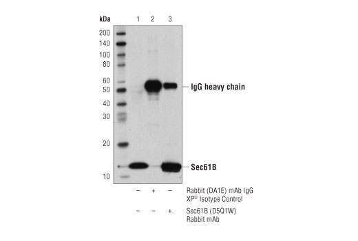 Sec61B (D5Q1W) Rabbit mAb | Cell Signaling Technology