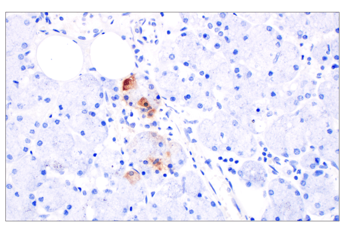 Immunohistochemistry Image 4: CXCL10 (F9N8I) Rabbit Monoclonal Antibody