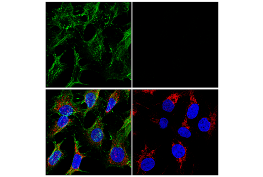 Immunofluorescence Image 1: beta-Catenin (D10A8) Rabbit Monoclonal Antibody (Alexa Fluor<sup>®</sup> 488 Conjugate)