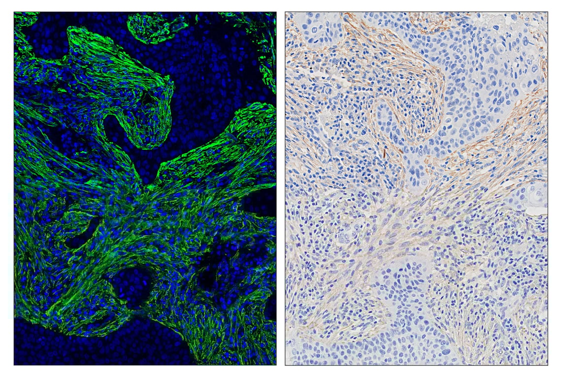 Immunohistochemistry Image 7: alpha-Smooth Muscle Actin (D4K9N) & CO-0024-488 SignalStar<sup>™</sup> Oligo-Antibody Pair