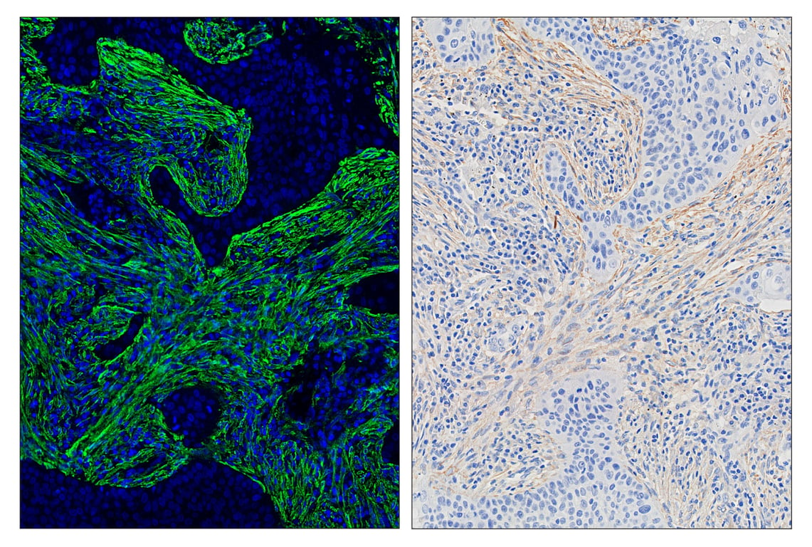 Immunohistochemistry Image 7: α-Smooth Muscle Actin (D4K9N) & CO-0024-594 SignalStar<sup>™</sup> Oligo-Antibody Pair