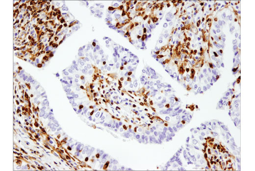 Immunohistochemistry Image 1: SLP-76 (D1R1A) Rabbit Monoclonal Antibody