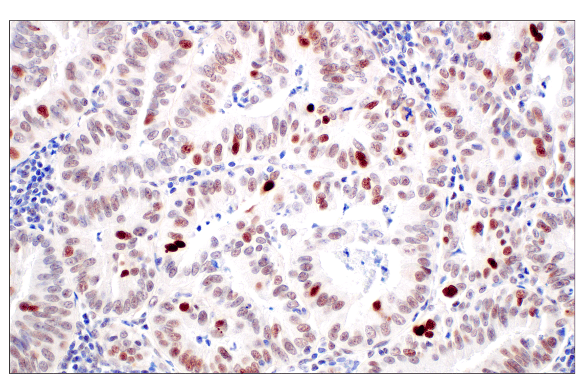 Immunohistochemistry Image 1: MDM2 (F7W7X) Rabbit Monoclonal Antibody (BSA and Azide Free)