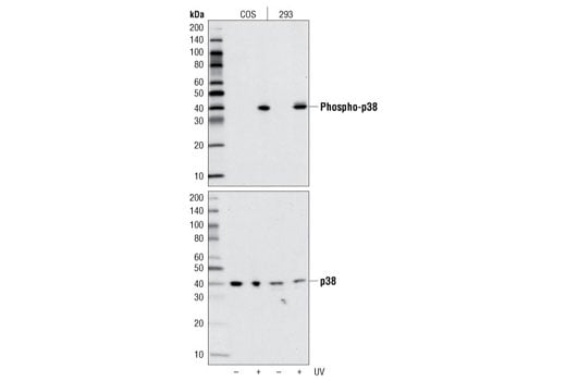 undefined Image 4: Angiogenesis Antibody Sampler Kit