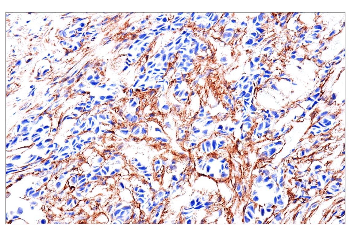 Immunohistochemistry Image 1: FAP (F1A4G) Rabbit mAb