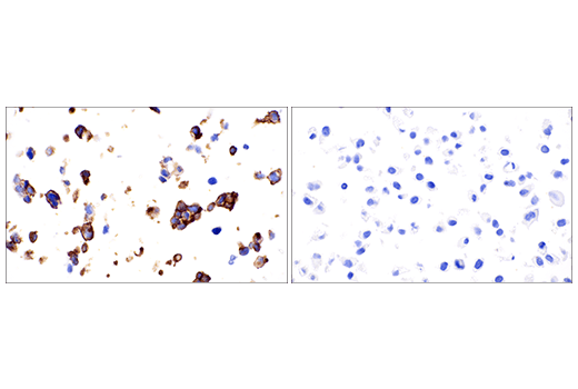 Immunohistochemistry Image 1: VE-Cadherin (E6N7A) Rabbit Monoclonal Antibody