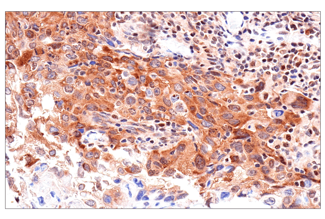 Immunohistochemistry Image 2: ADAR1 p150 Isoform (E6U1U) Rabbit Monoclonal Antibody