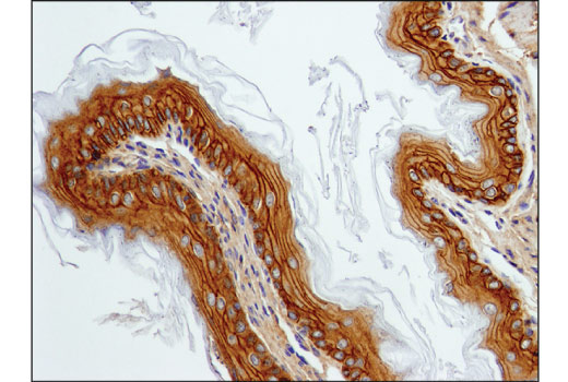 Immunohistochemistry Image 1: EGF Receptor (D1P9C) Rabbit Monoclonal Antibody (BSA and Azide Free)