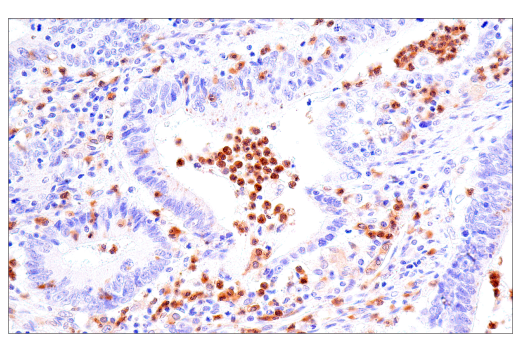 Immunohistochemistry Image 1: LRRK2 (E8Z7T) Mouse mAb