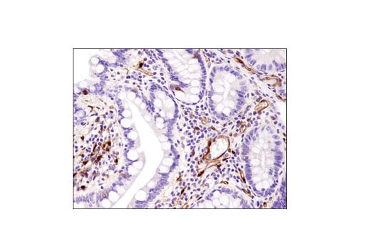 Immunohistochemistry Image 1: FABP5 (D1A7T) Rabbit Monoclonal Antibody (BSA and Azide Free)