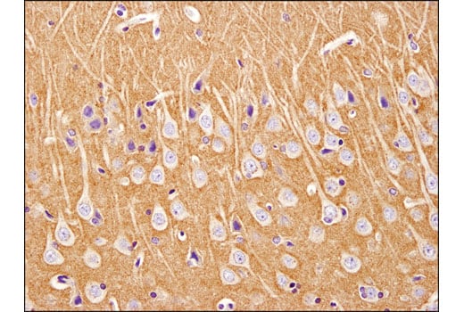 Immunohistochemistry Image 4: Spinophilin (E1E7R) Rabbit Monoclonal Antibody
