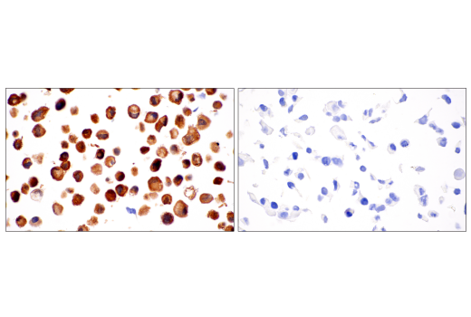 Immunohistochemistry Image 2: NNMT (E6N2Z) Rabbit Monoclonal Antibody