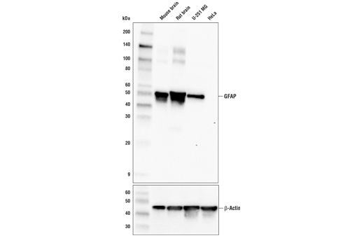 Western Blotting Image 1: GFAP (E4L7M) XP<sup>®</sup> Rabbit mAb (BSA and Azide Free)