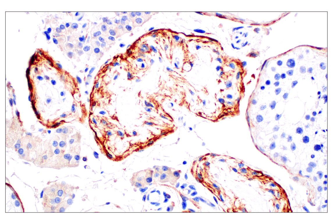Immunohistochemistry Image 6: Neuropilin-2 (E5Q2G) Rabbit Monoclonal Antibody