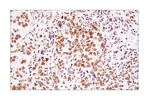 Immunohistochemistry Image 2: BRD4 (E2A7X) Rabbit Monoclonal Antibody (BSA and Azide Free)