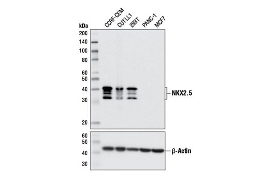 Western Blotting Image 1: NKX2.5 (E1Y8H) Rabbit mAb