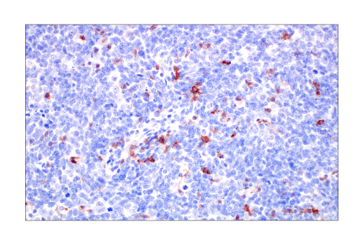 Immunohistochemistry Image 5: TIGIT (E5Y1W) Rabbit Monoclonal Antibody