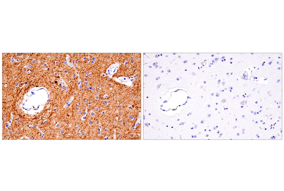 Immunohistochemistry Image 4: Neurofilament-M (E7L2T) Rabbit Monoclonal Antibody (BSA and Azide Free)