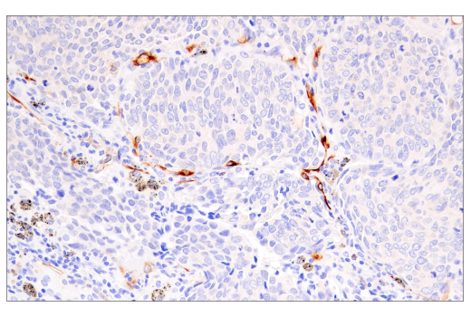 Immunohistochemistry Image 1: HLA-G (E8N9C) Rabbit Monoclonal Antibody (BSA and Azide Free)