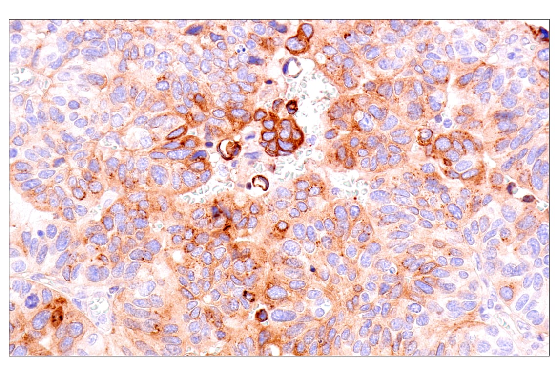 Immunohistochemistry Image 5: GDF15/MIC1 (E5Q8Q) Rabbit Monoclonal Antibody