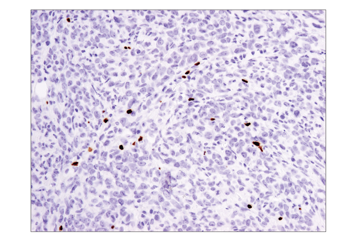 FoxP3 (D6O8R) Rabbit mAb | Cell Signaling Technology