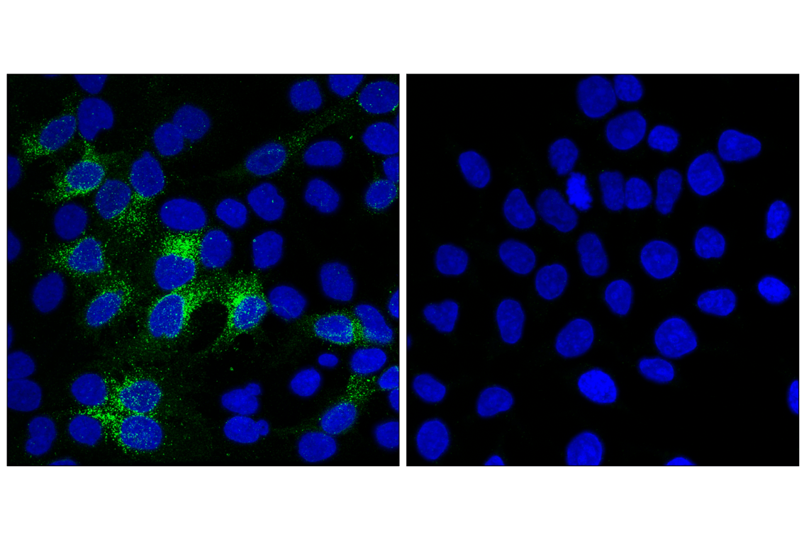Immunofluorescence Image 1: ALPP/ALPPL2 (F1L4G) Rabbit Monoclonal Antibody